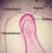 Histologic slide showing enamel formation.